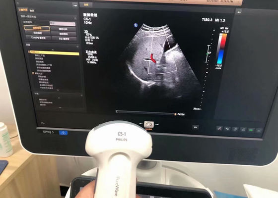 Philip C5-1 Abdominal Medical Ultrasound Probe Untuk perangkat EPIQ 5