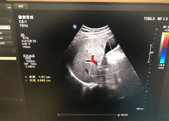 Philip C5-1 Abdominal Medical Ultrasound Probe Untuk perangkat EPIQ 5