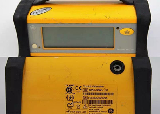 Oksimeter Portable Untuk Rumah Sakit