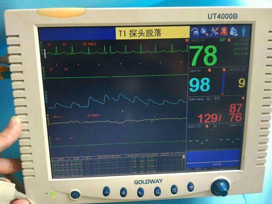 Goldway UT4000B Monitor Pasien Perbaikan Monitor Pasien Medis Pemeliharaan
